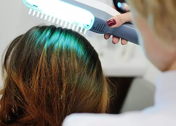 Liệu pháp laser điều trị chứng rụng tóc và các phòng khám hàng đầu